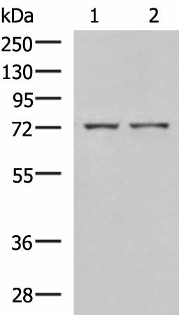 Western blot analysis of Mouse liver tissue and Jurkat cell lysates using ZAP70 Polyclonal Antibody at dilution of 1:800