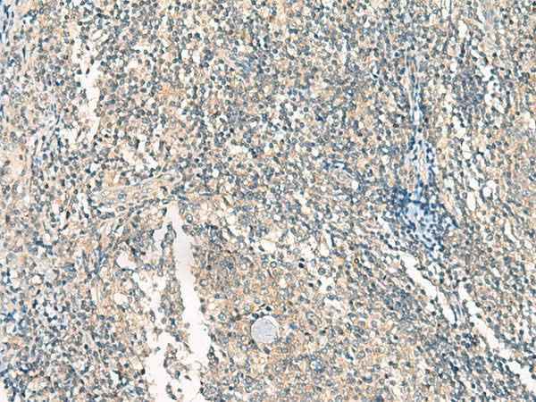 Anti-Human HASPIN Antibody