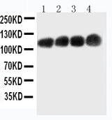 Anti-CEACAM5/Cd66e Monoclonal Antibody Boster Bio