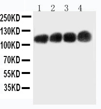 Anti-CEACAM5/Cd66e Monoclonal Antibody Boster Bio