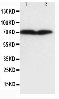 Anti-Collagen, Type III Col3a1 Antibody (Monoclonal, FH-7A) Boster Bio