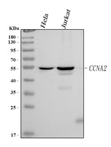 Anti-Cyclin A Ccna2 Antibody (Monoclonal, CY-A1) Boster Bio