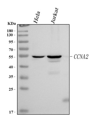 Anti-Cyclin A Ccna2 Antibody (Monoclonal, CY-A1) Boster Bio