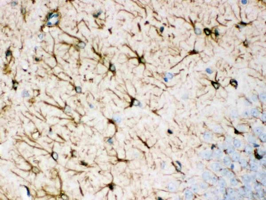 Anti-GFAP Antibody (Monoclonal, G-A-5) Boster Bio