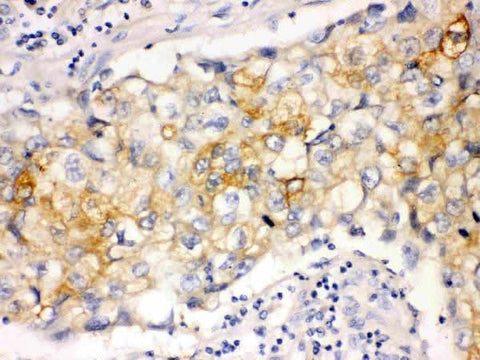 Anti-Involucrin Ivl Antibody (Monoclonal, SY5) Boster Bio