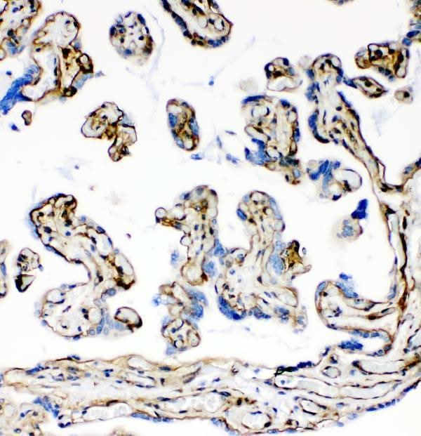 Anti-Laminin LAMA1 Monoclonal Antibody Boster Bio