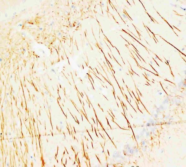 Anti-MAP2 Antibody (Monoclonal, HM-2) Boster Bio