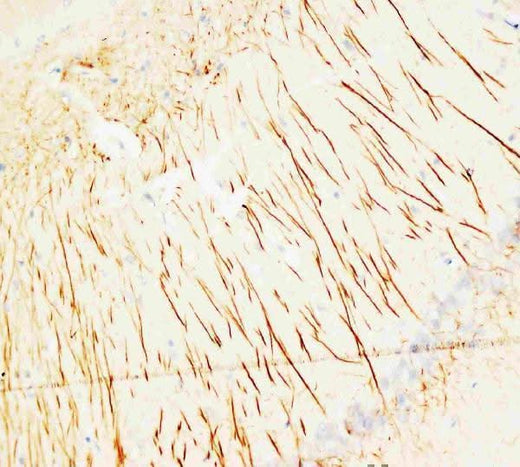 Anti-MAP2 Antibody (Monoclonal, HM-2) Boster Bio