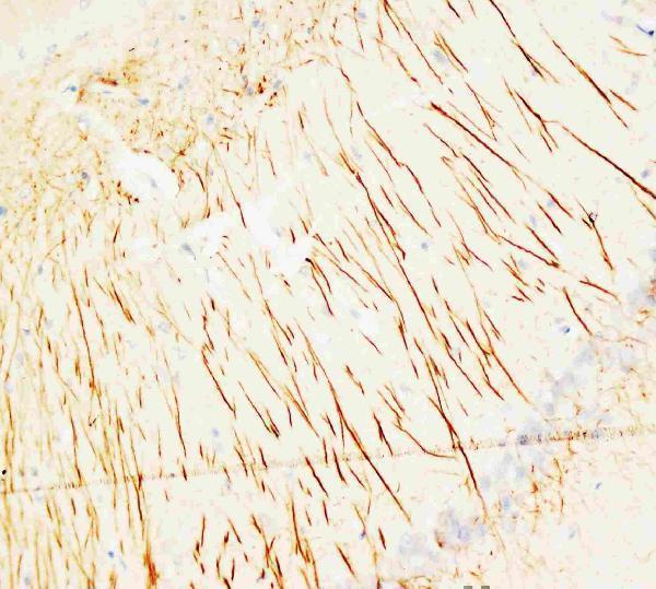 Anti-MAP2 Antibody (Monoclonal, HM-2) Boster Bio