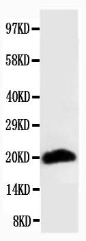 Anti-Myosin(Skeletal, Fast) MYH2 Antibody (Monoclonal, MY-32) Boster Bio