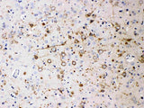 Anti-NEFH Antibody (Monoclonal, N52) Boster Bio
