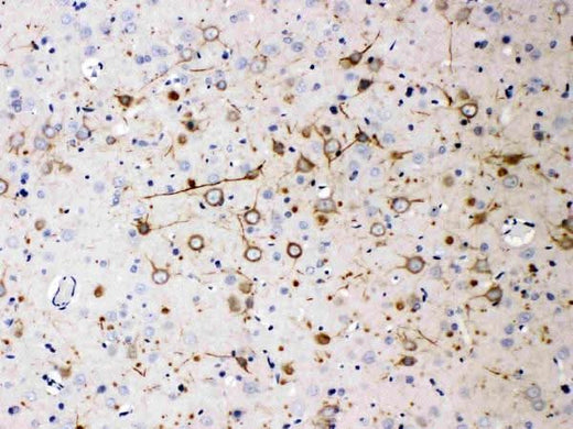 Anti-NEFH Antibody (Monoclonal, N52) Boster Bio