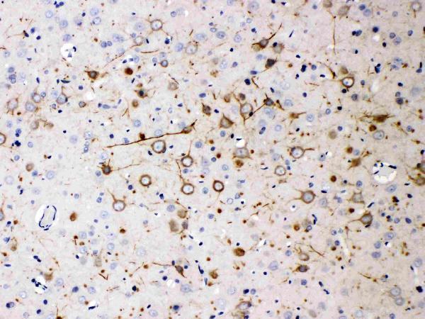 Anti-NEFH Antibody (Monoclonal, N52) Boster Bio