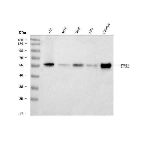 Anti-P53 Tp53 Monoclonal Antibody Boster Bio