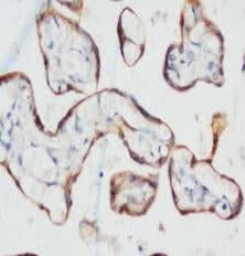 Anti-PCK Antibody (Monoclonal, C-11+PCK-26+CY-90+KS-1A3+M20+A53-B/A2) Boster Bio