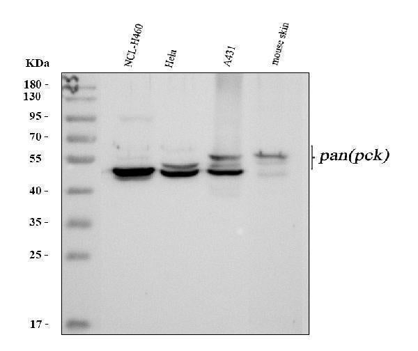 Anti-Pan cytokeratin Antibody (Monoclonal, PCK-26) Boster Bio