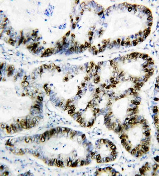 Anti-PCNA Antibody (Monoclonal, PC 10) Boster Bio