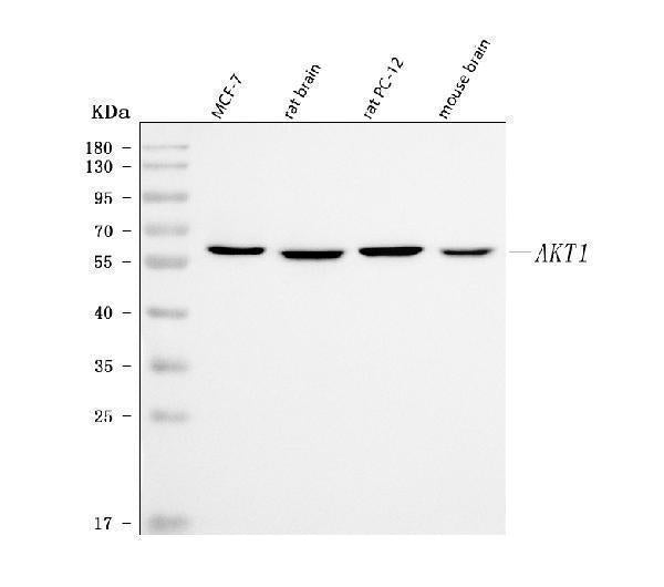 Anti-PKB Alpha Akt1 Antibody (Monoclonal, PKB-175) Boster Bio