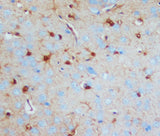 Anti-S-100(Beta-subunit) S100b Antibody (Monoclonal, SH-B1) Boster Bio