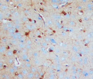 Anti-S-100(Beta-subunit) S100b Antibody (Monoclonal, SH-B1) Boster Bio