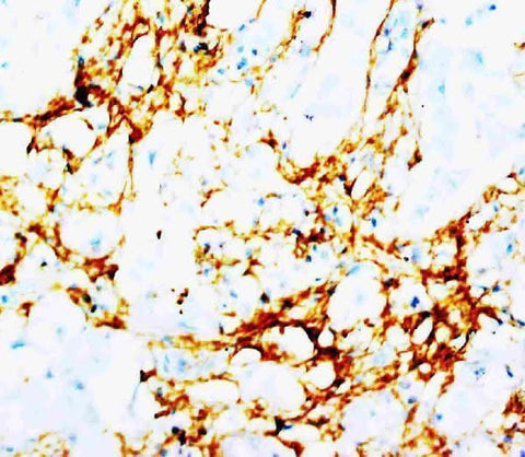 Anti-Tenascin TNN Antibody (Monoclonal, BC-24) Boster Bio