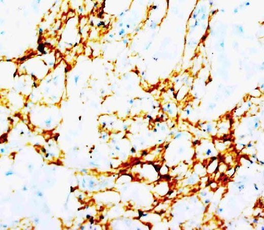 Anti-Tenascin TNN Antibody (Monoclonal, BC-24) Boster Bio