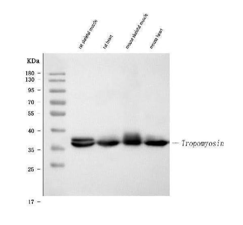Anti-Tropomyosin(36/39 kDa) Tpm1 Antibody (Monoclonal, TM31) Boster Bio