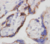 Anti-Beta-HCG CGB Antibody (Monoclonal, PC-2) Boster Bio