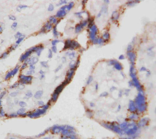 Anti-Beta-HCG CGB Antibody (Monoclonal, PC-2) Boster Bio