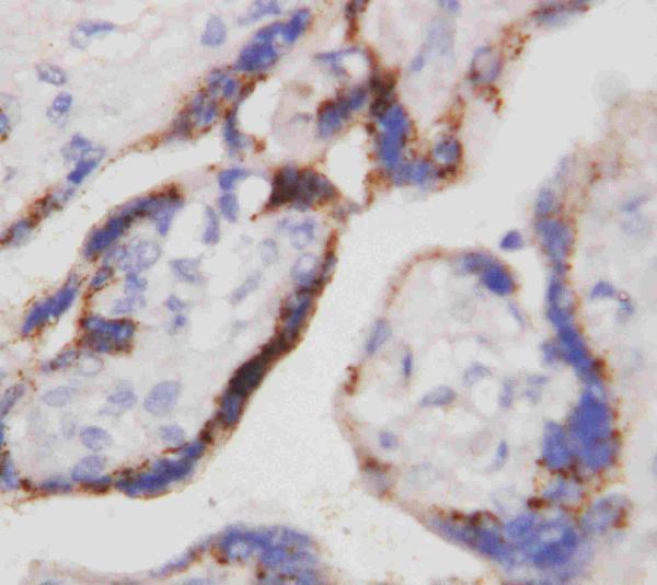 Anti-Beta-HCG CGB Antibody (Monoclonal, PC-2) Boster Bio