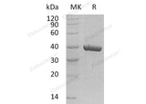 Recombinant Human CA11 Protein (His Tag) - ABMIUM