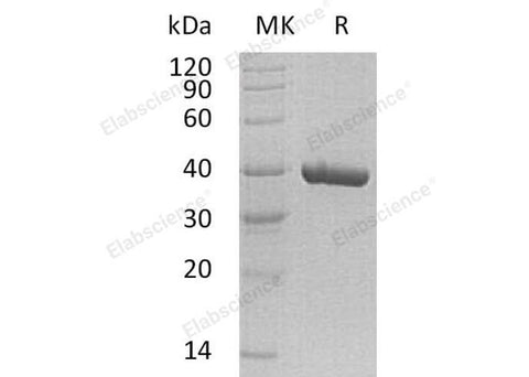 Recombinant Human CA11 Protein (His Tag) - ABMIUM