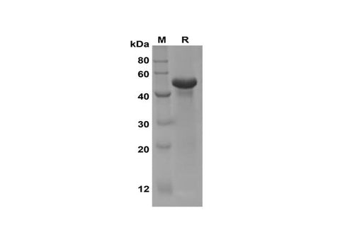 SDS-PAGE analysis of Human Urokinase/uPA proteins, 2 μg/lane of Recombinant Human Urokinase/uPA proteins was resolved with SDS-PAGE under reducing conditions, showing bands at 47 kDa.