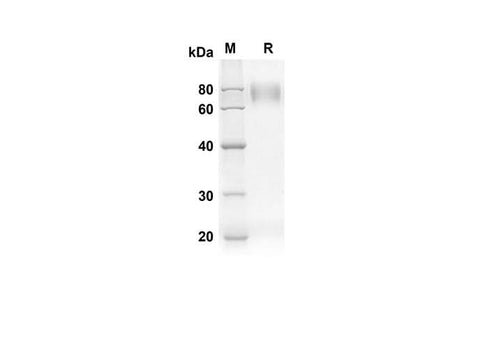 SDS-PAGE analysis of Human CD80 proteins, 2 μg/lane of Recombinant Human CD80 proteins was resolved with an SDS-PAGE under reducing conditions, showing bands at 47.7 kDa.