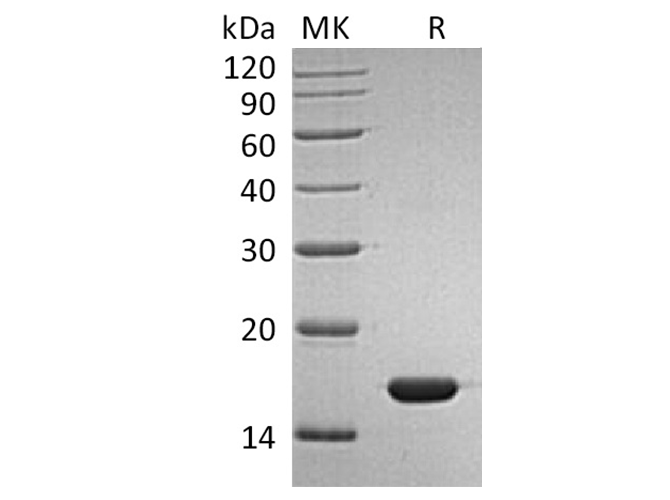 Recombinant Human IFNα2b/IFNA2 Protein - ABMIUM