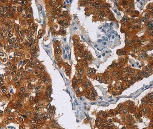Anti-Human/Mouse/Rat CRABP2 Antibody