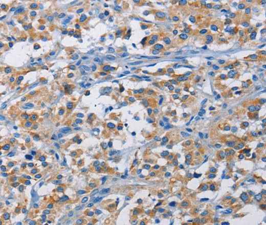 Anti-Human/Mouse RICTOR Antibody