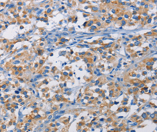 Anti-Human/Mouse RICTOR Antibody - ABMIUM