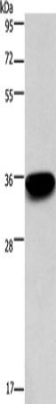 Anti-Human/Mouse PRPS1/2/PRPS1L1 Antibody - ABMIUM