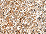 Anti-Human/Mouse/Rat GCC2 Antibody - ABMIUM
