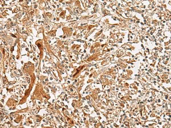 Anti-Human/Mouse/Rat GCC2 Antibody