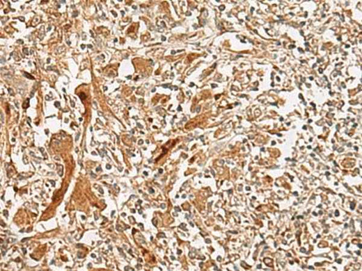 Anti-Human/Mouse/Rat GCC2 Antibody