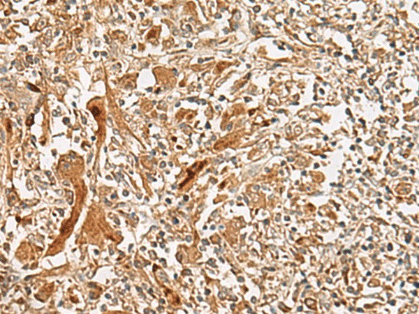 Anti-Human/Mouse/Rat GCC2 Antibody - ABMIUM
