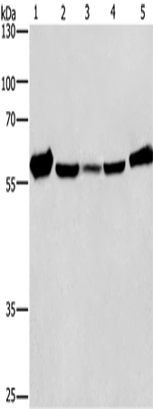 Anti-Human/Mouse/Rat CAT Antibody - ABMIUM