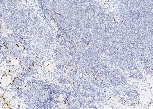 Anti-Human LCN2 Antibody [B230] - ABMIUM