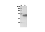SDS-PAGE analysis of Human Rock-2 proteins, 2 μg/lane of Recombinant Human Rock-2 proteins was resolved with SDS-PAGE under reducing conditions, showing bands at 39 kDa.