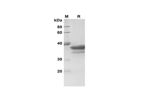 SDS-PAGE analysis of Human Rock-2 proteins, 2 μg/lane of Recombinant Human Rock-2 proteins was resolved with SDS-PAGE under reducing conditions, showing bands at 39 kDa.