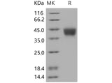 SDS-PAGE analysis of Human CD200 proteins, 2 μg/lane of Recombinant Human CD200 proteins was resolved with SDS-PAGE under reducing conditions, showing bands at 35 kDa.