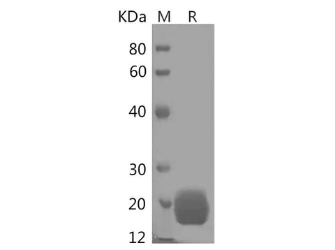 SDS-PAGE analysis of Human LAIR2/CD306 proteins, 2 μg/lane of Recombinant Human LAIR2/CD306 proteins was resolved with SDS-PAGE under reducing conditions, showing bands at 19 kDa.
