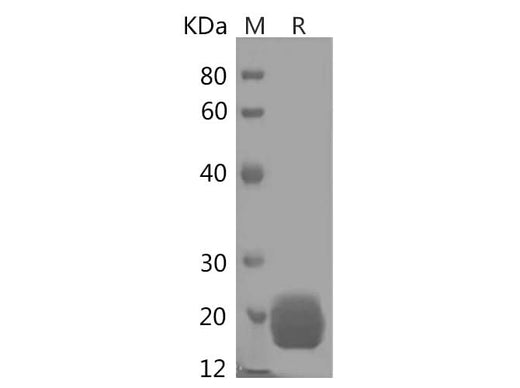 SDS-PAGE analysis of Human LAIR2/CD306 proteins, 2 μg/lane of Recombinant Human LAIR2/CD306 proteins was resolved with SDS-PAGE under reducing conditions, showing bands at 19 kDa.